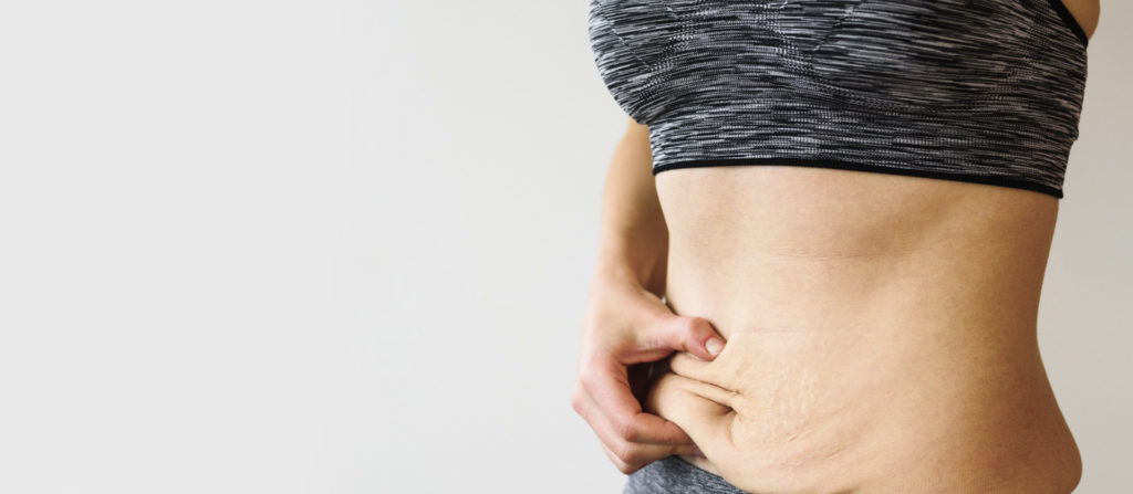 barriga pós-parto