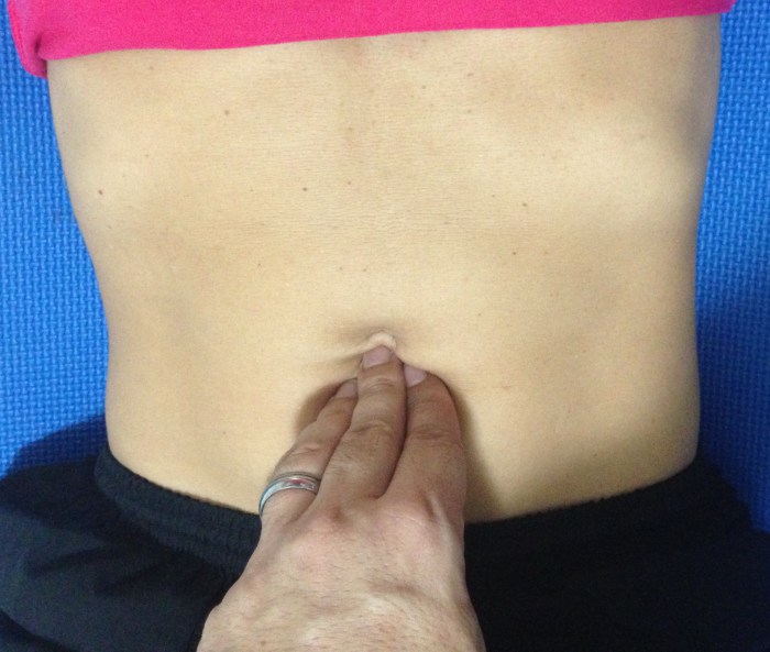 teste barriga diastase